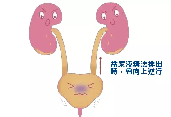 前列腺會堵在膀胱頸口，引起排尿不暢