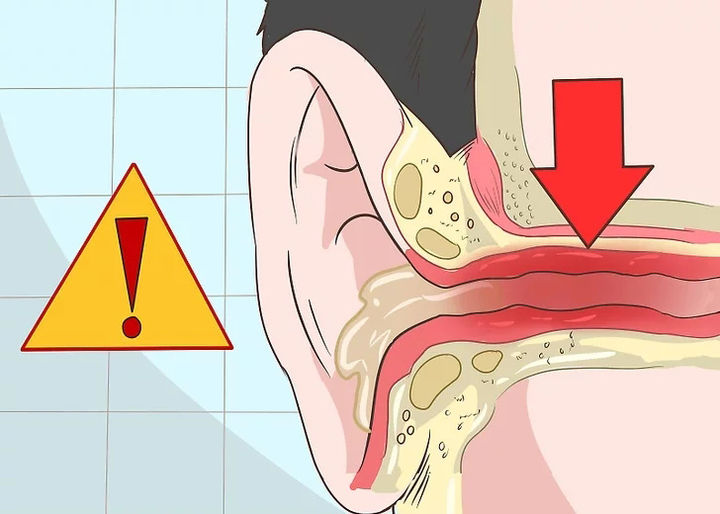 耳朵本身或耳部疾病