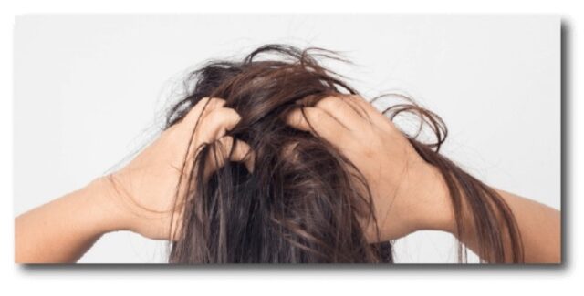 頭皮癢怎麼辦？醫師分析原因 7 招幫你解決頭皮癢