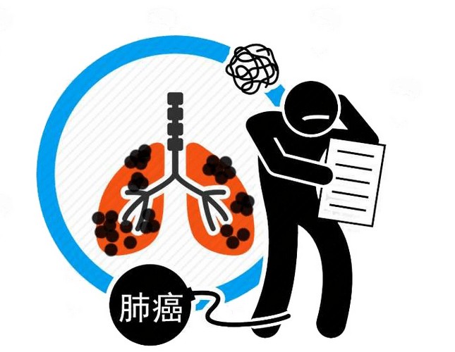 肺癌早期有徵兆
