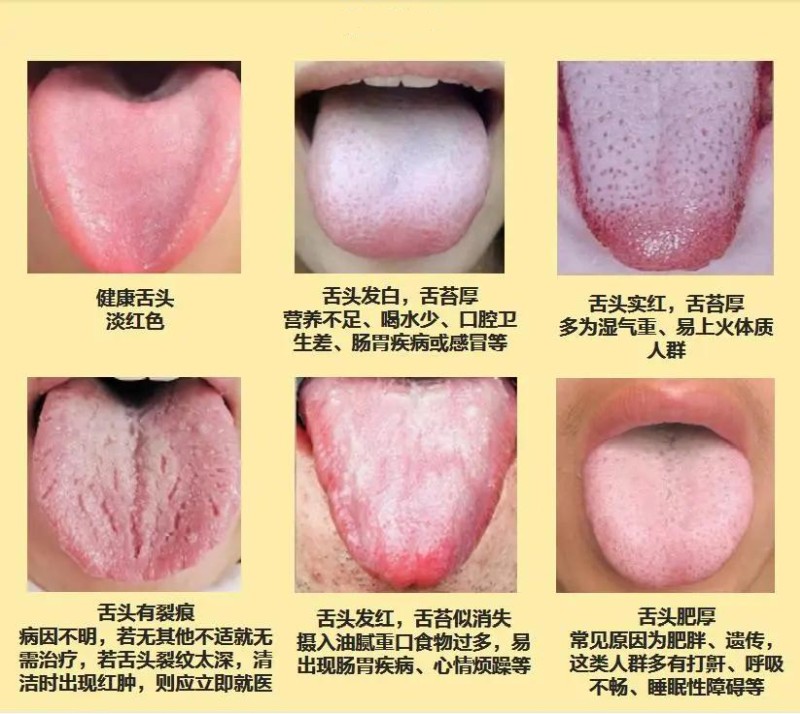 查看不同人群舌頭對應症